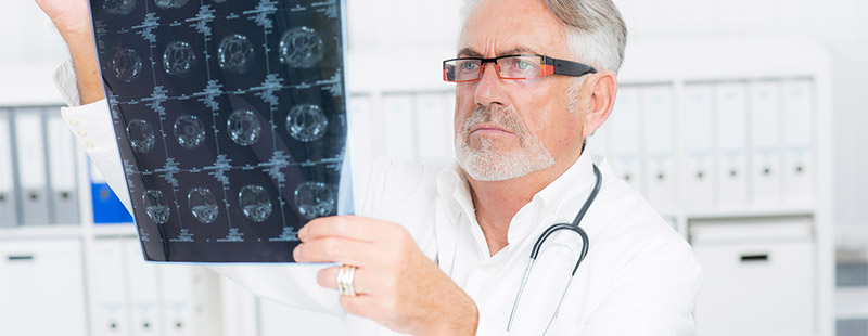 Ein Arzt mit Brille der gerade ein Röntgenbild in die Luft hält und sich dieses anschaut. Im Hintergrund sind Schränke mit Ordner zu sehen